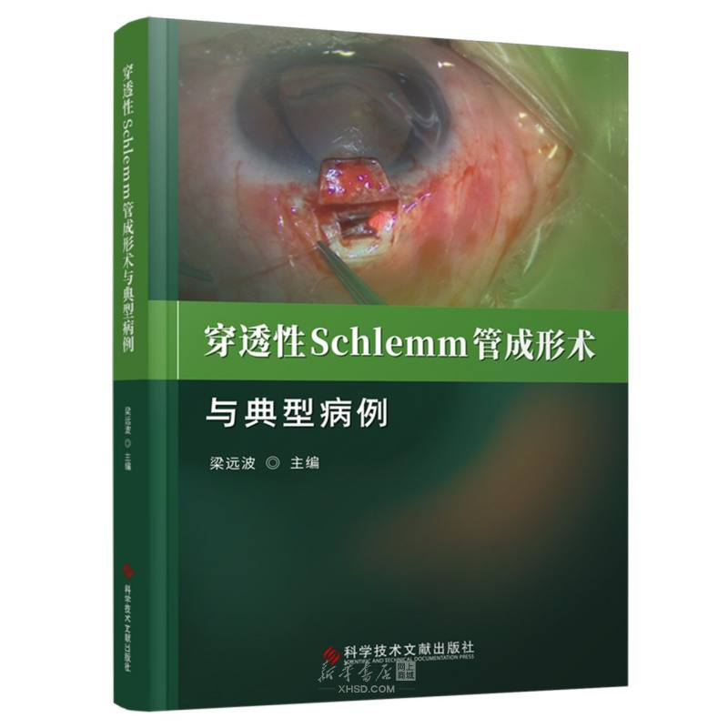 《穿透性Schlemm管成形术与典型病例》